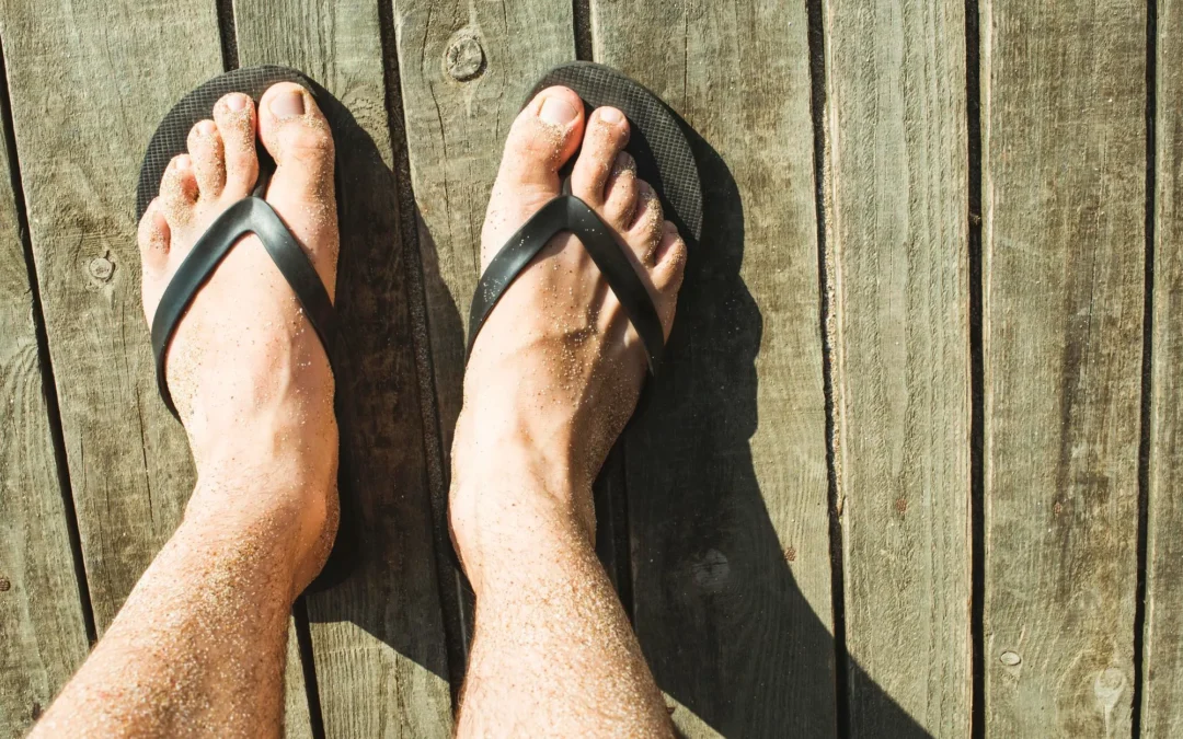 Las chanclas en verano: hábitos que pueden ser peligrosos